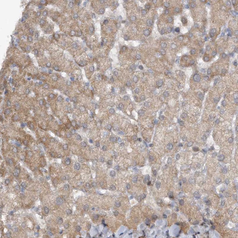 Staining of human liver shows moderate cytoplasmic positivity in hepatocytes.