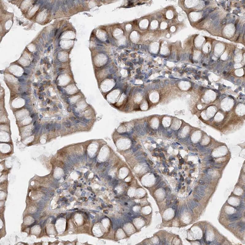 Staining of human small intestine shows moderate cytoplasmic positivity in glandular cells.