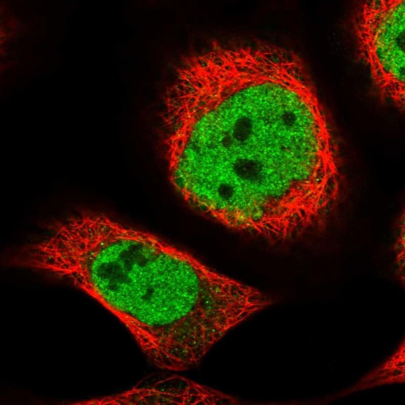 Staining of human cell line A-431 shows localization to nucleoplasm.