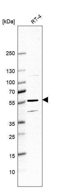 Analysis in human cell line RT-4.