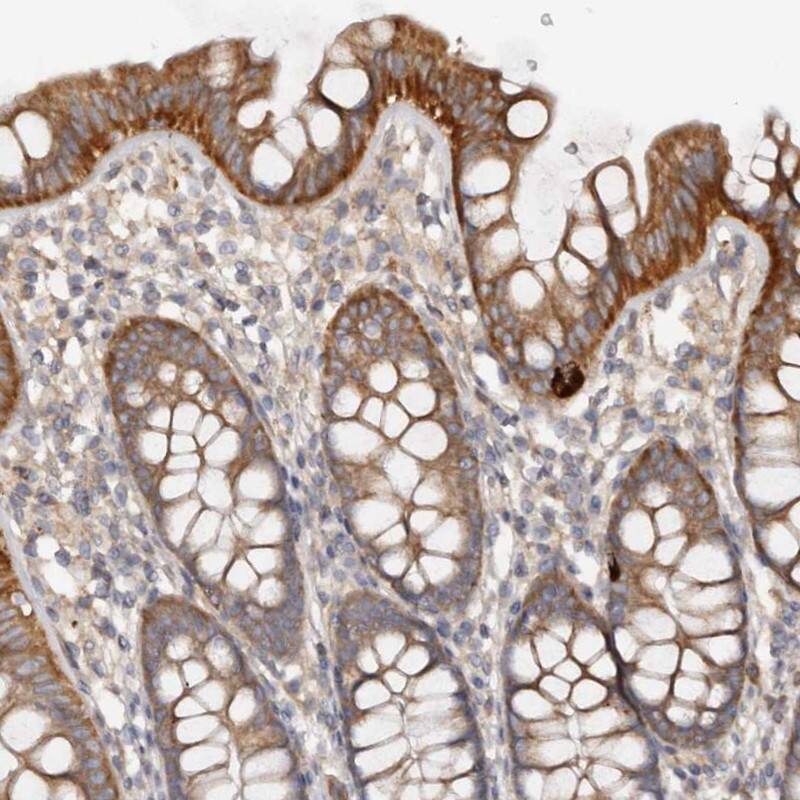 Staining of human colon shows distinct cytoplasmic positivity in glandular cells.