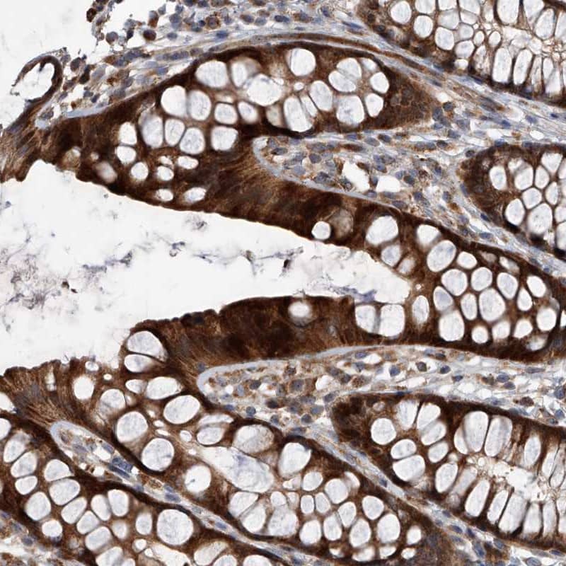 Staining of human rectum shows strong cytoplasmic positivity in glandular cells.