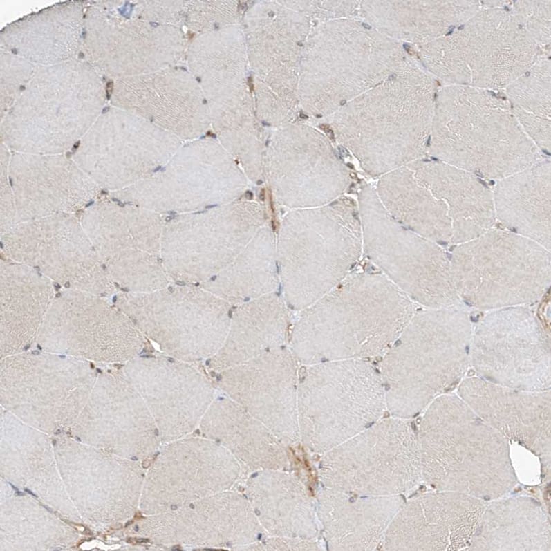 Immunohistochemistry-Paraffin CSMD3 Antibody - BSA Free
