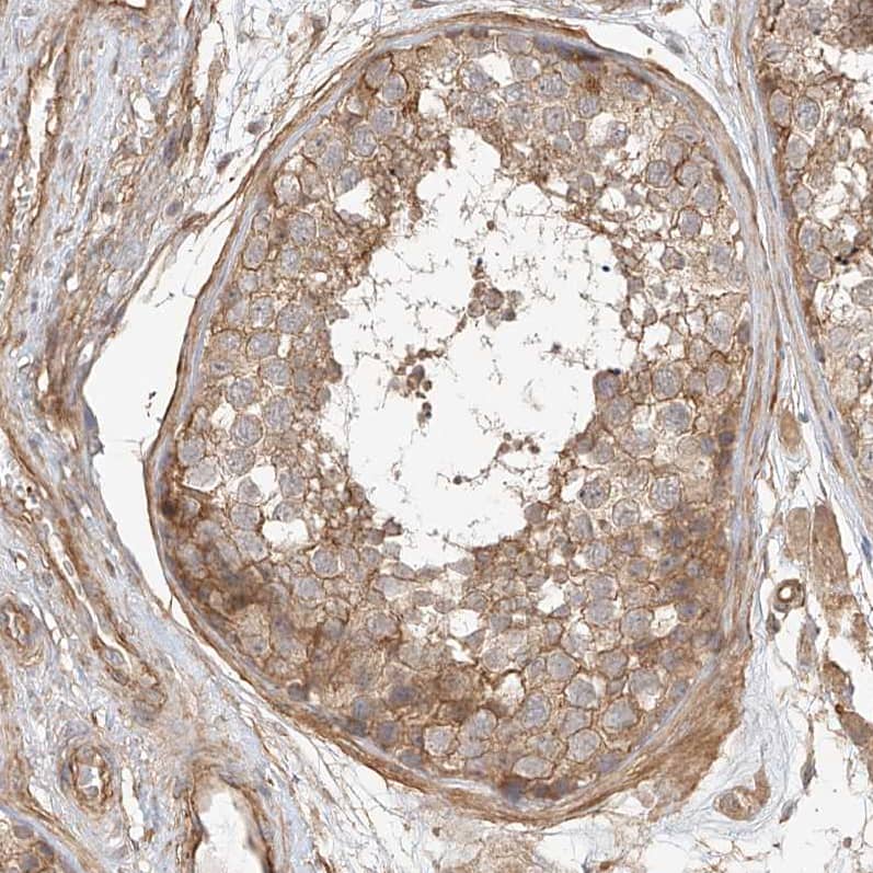 Immunohistochemistry-Paraffin CSMD3 Antibody - BSA Free