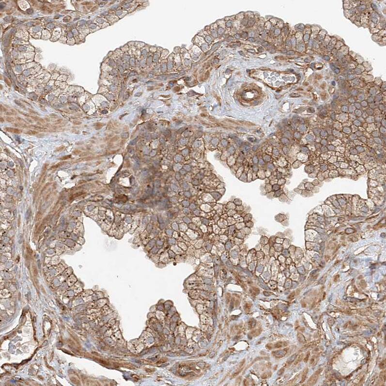 Staining of human prostate shows moderate membranous positivity in glandular cells.
