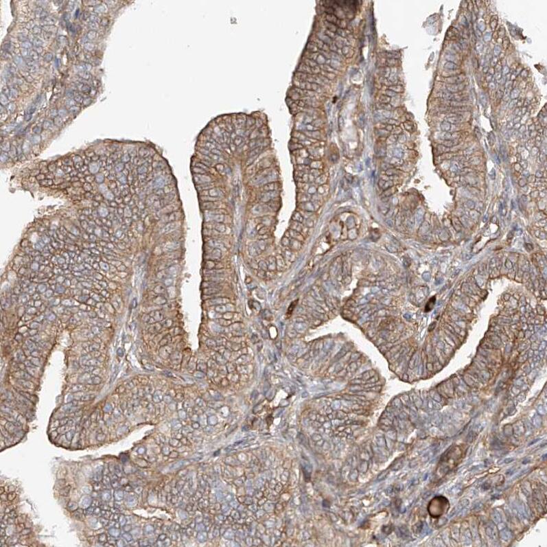 Staining of human Fallopian tube shows moderate membranous positivity in glandular cells.