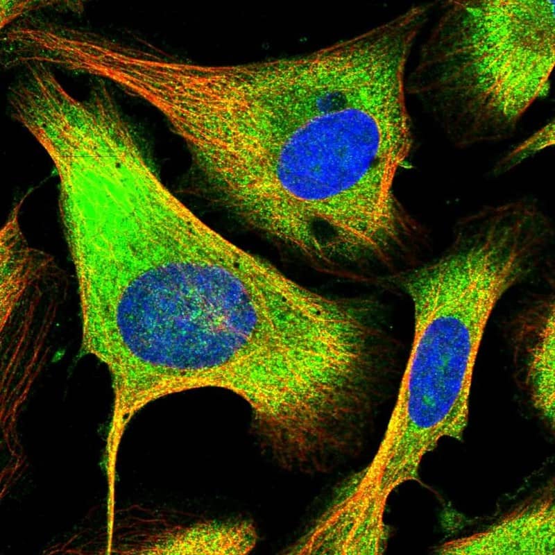Staining of human cell line U-2 OS shows localization to cytosol.