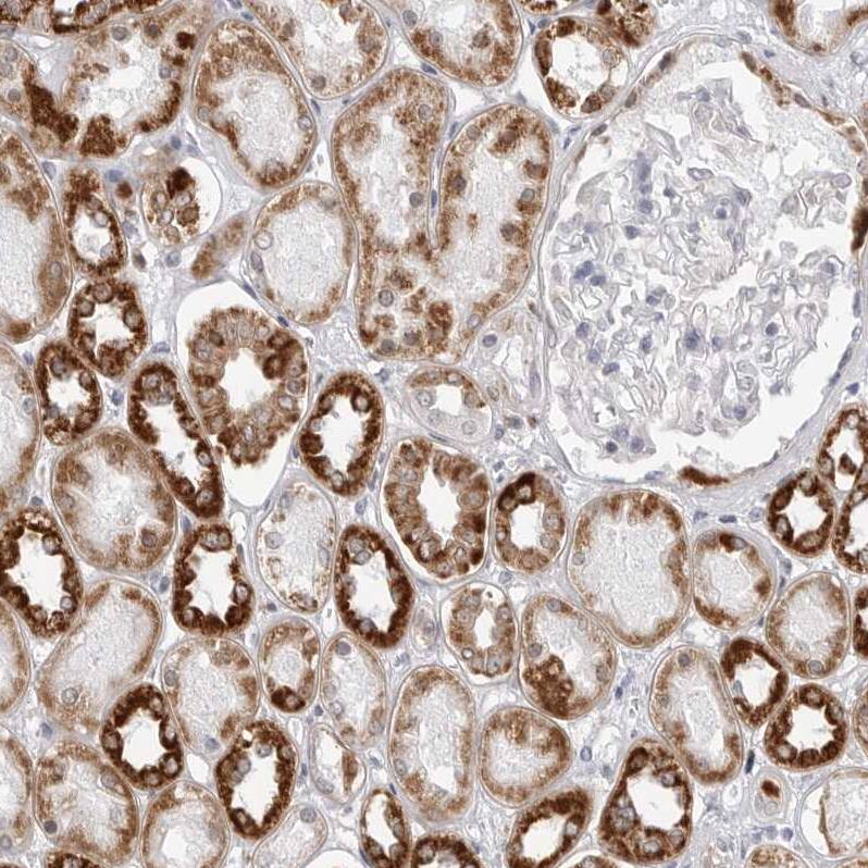 Staining of human kidney shows strong granular cytoplasmic positivity in cells in tubules.