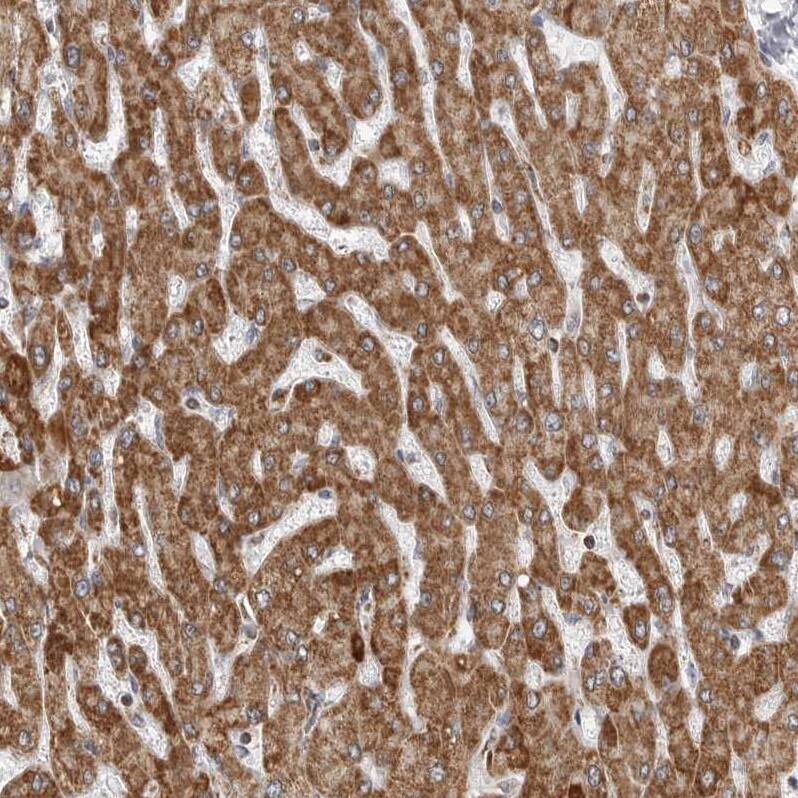 Staining of human liver shows strong granular cytoplasmic positivity in hepatocytes.