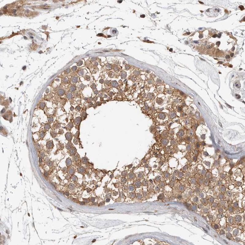 Immunohistochemistry-Paraffin OSBPL9 Antibody - BSA Free