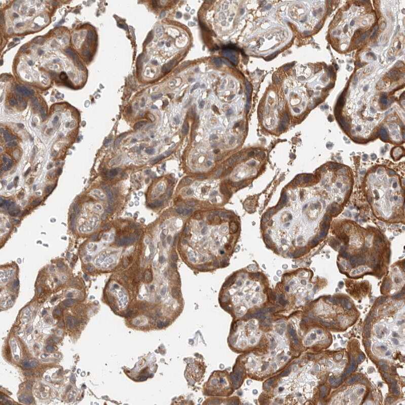 Immunohistochemistry-Paraffin OSBPL9 Antibody - BSA Free