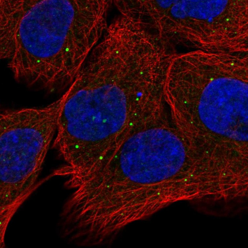 Staining of human cell line A-431 shows positivity in vesicles.