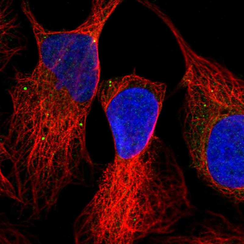 Staining of human cell line U-2 OS shows localization to vesicles.