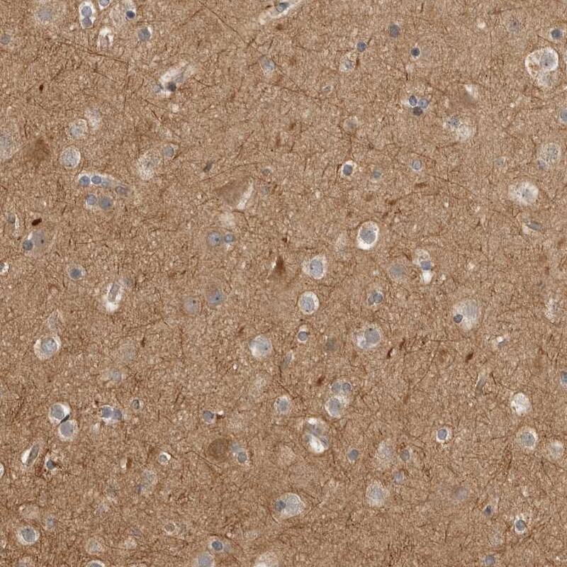 Staining of human cerebral cortex shows moderate positivity in neuronal cells, endothelial cells and in neuropil.