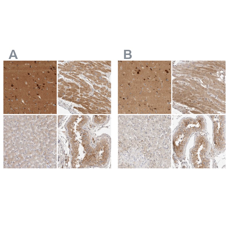<b>Independent Antibodies Validation. </b>Staining of human cerebral cortex, heart muscle, liver and testis using Anti-TOM1L2 antibody NBP1-86414 (A) shows similar protein distribution across tissues to independent antibody NBP1-86006 (B).
