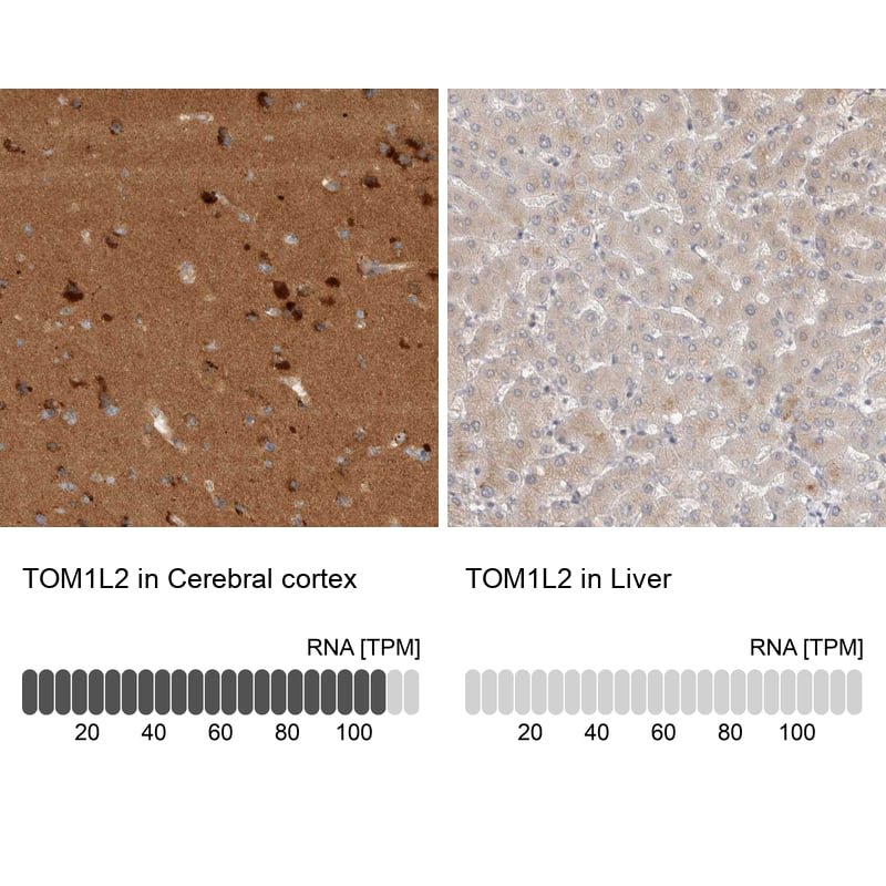 <b>Orthogonal Strategies Validation. </b>Analysis in human cerebral cortex and liver tissues Corresponding TOM1L2 RNA-seq data are presented for the same tissues.