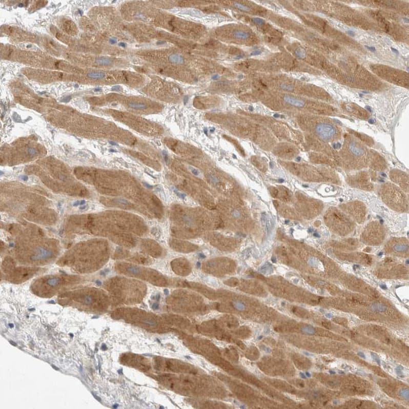 Staining of human heart muscle shows moderate granular cytoplasmic positivity in cardiomyocytes.