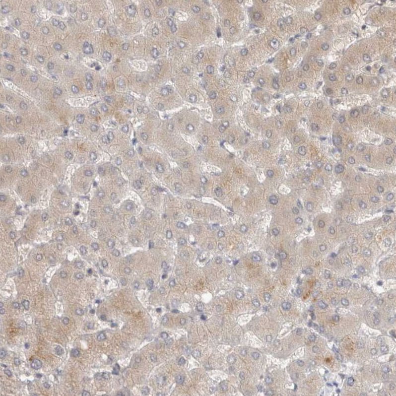 Staining of human liver shows very weak cytoplasmic positivity in hepatocytes.