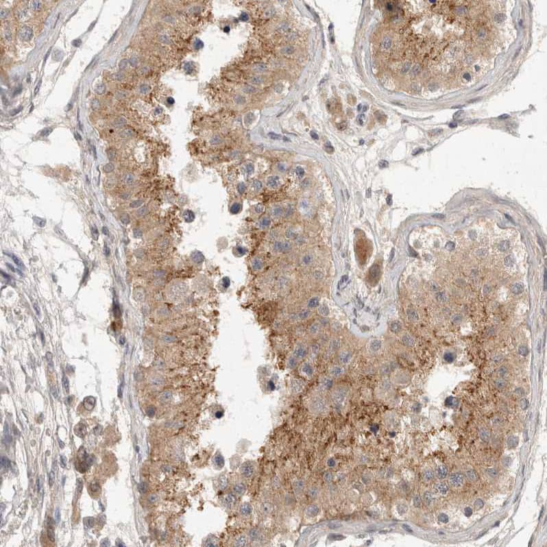 Staining of human testis shows moderate granular cytoplasmic positivity in cells in seminiferous ducts.