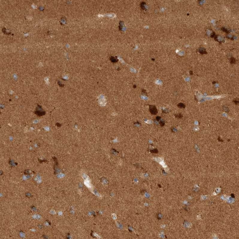 Staining of human cerebral cortex shows strong cytoplasmic positivity in neurons.