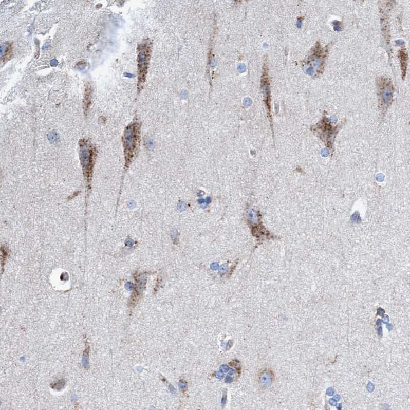 Staining of human cerebral cortex shows strong cytoplasmic granular positivity in neurons.