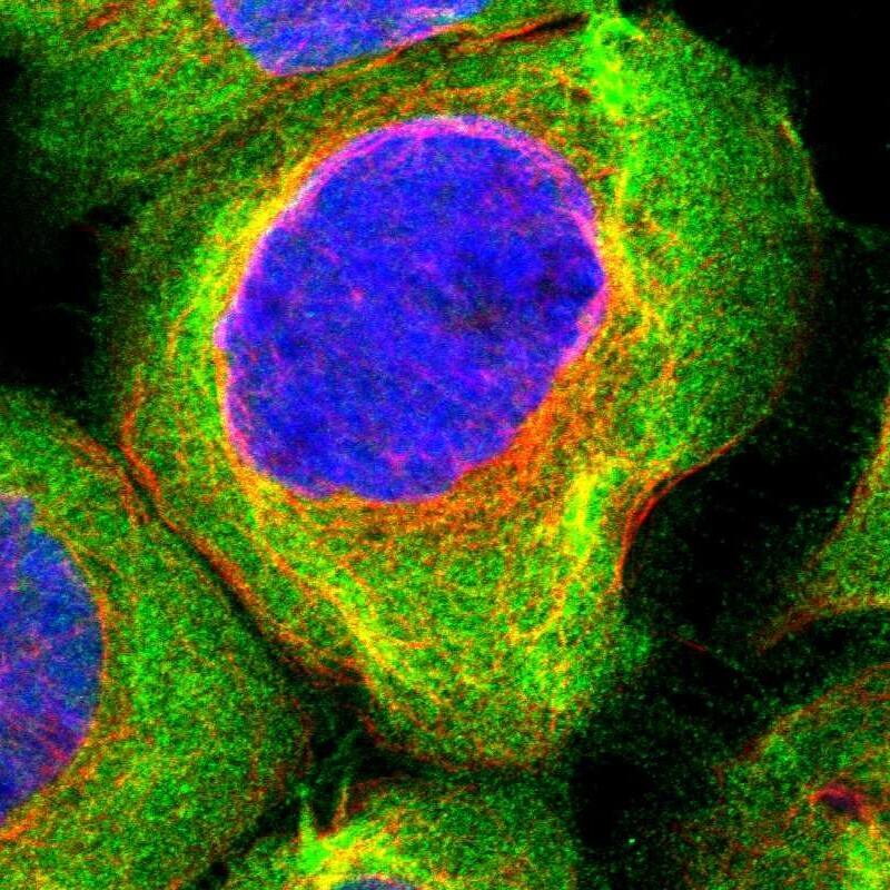 Staining of human cell line A-431 shows localization to plasma membrane & cytosol.