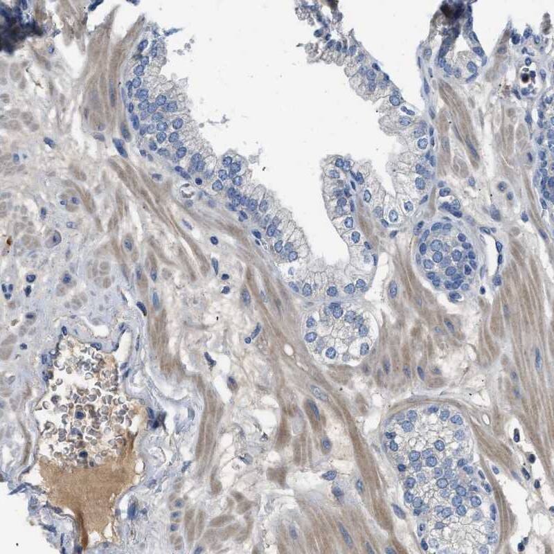 Staining of human prostate shows distinct positivity in plasma.