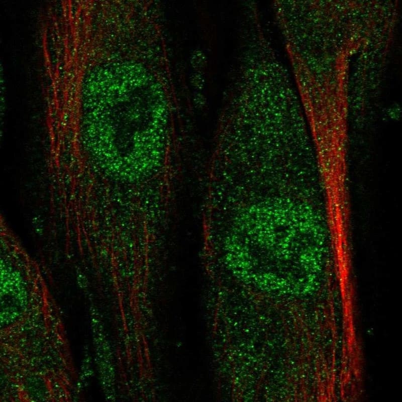 Staining of human cell line ASC TERT1 shows localization to nucleoplasm.