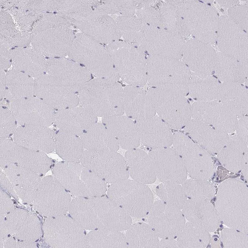 Staining of human skeletal muscle shows no positivity in myocytes as expected.