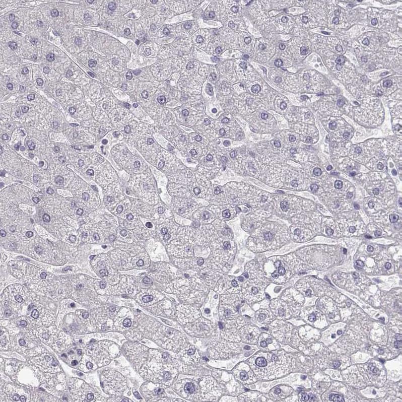 Staining of human liver shows no positivity in hepatocytes as expected.