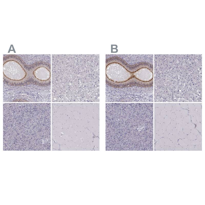 <b>Independent Antibodies Validation and Orthogonal Strategies Validation.</b>Staining of human epididymis, liver, pancreas and skeletal muscle using Anti-ZNF185 antibody NBP1-86452 (A) shows similar protein distribution across tissues to independent antibody NBP1-86192 (B).