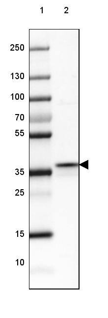 Lane 1: Marker [kDa] 250, 130, 100, 70, 55, 35, 25, 15, 10Lane 2: Human Skeletal muscle tissue