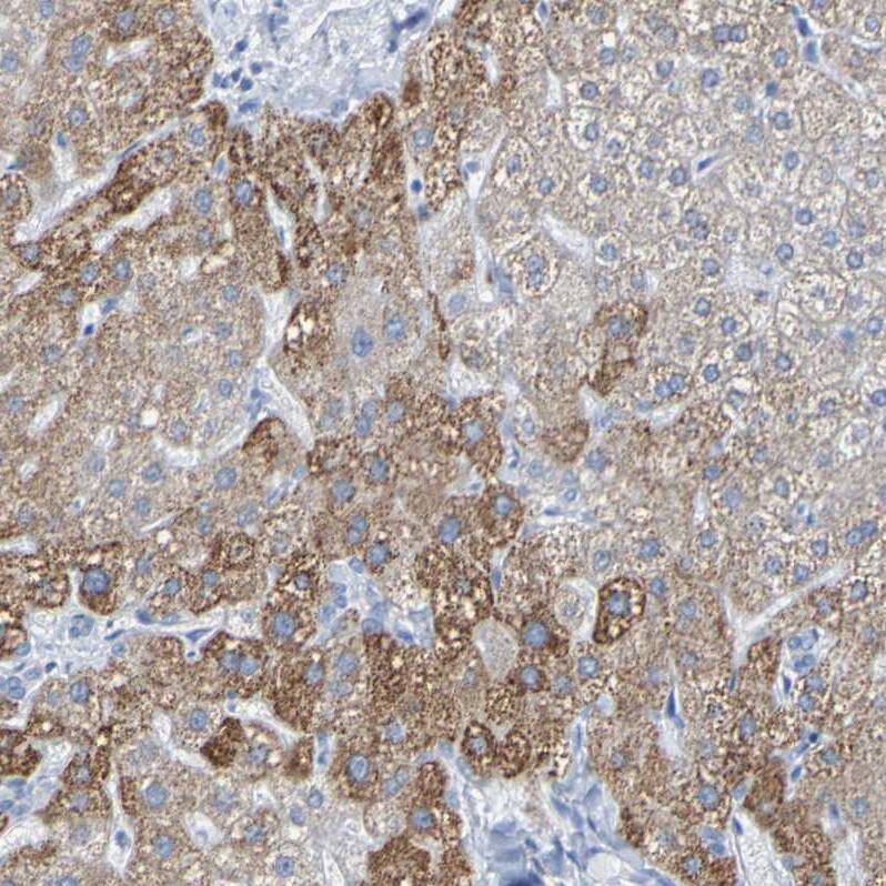 Staining of human liver shows moderate cytoplasmic positivity in hepatocytes.