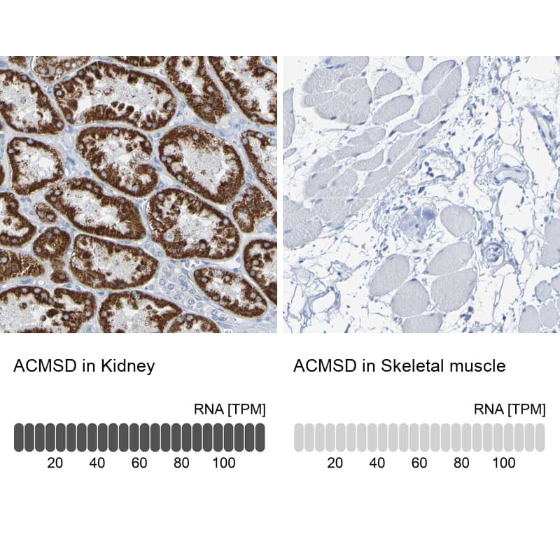 <b>Orthogonal Strategies Validation. </b>Analysis in human kidney and skeletal muscle tissues Corresponding ACMSD RNA-seq data are presented for the same tissues.