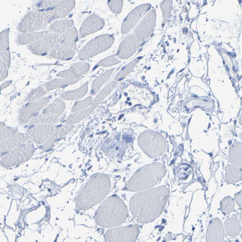 Staining of human skeletal muscle shows negative cytoplasmic positivity in myocytes as expected.