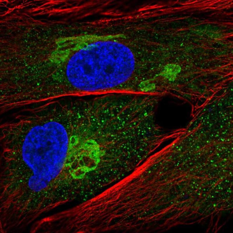 Staining of human cell line BJ shows localization to cytosol & the Golgi apparatus.