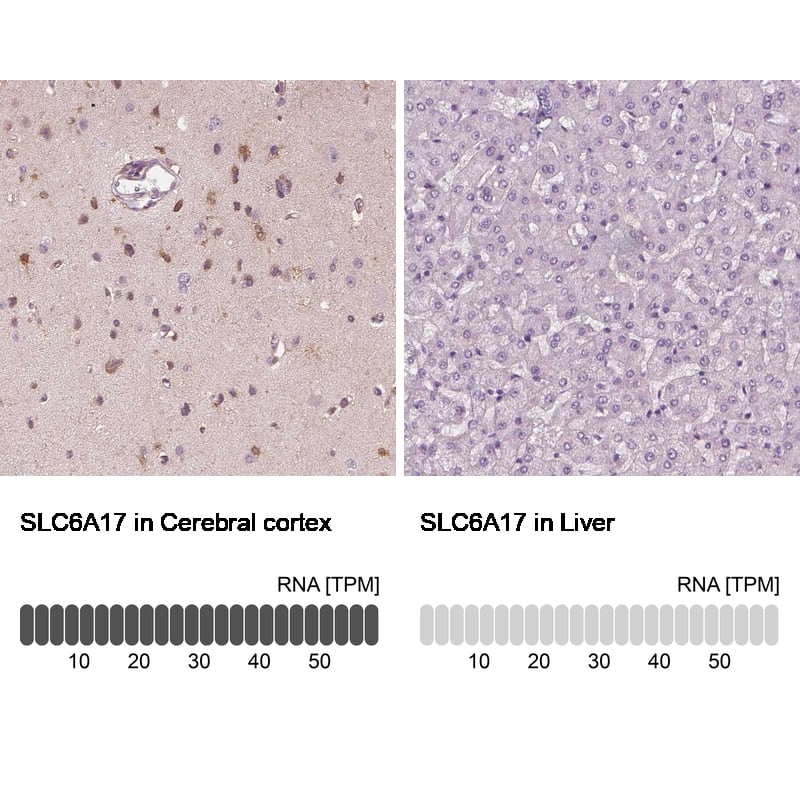 Analysis in human cerebral cortex and liver tissues Corresponding SLC6A17 RNA-seq data are presented for the same tissues.