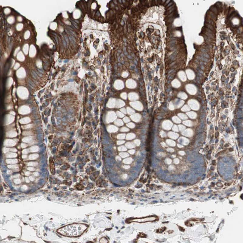 Staining of human colon shows strong cytoplasmic positivity in glandular cells.