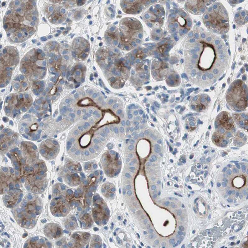 Staining of human salivary gland shows strong membranous positivity in glandular cells.