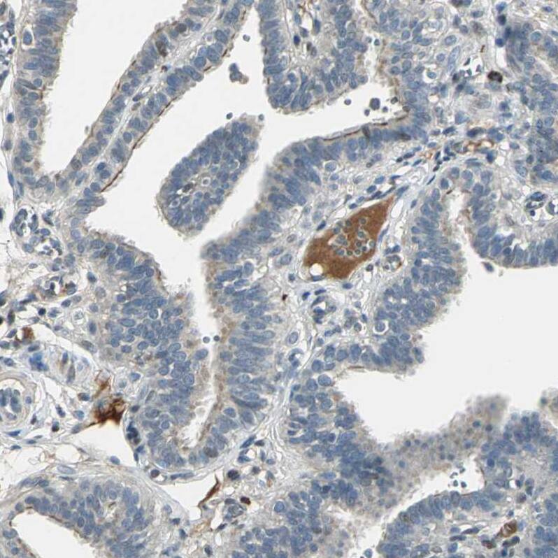 Staining of human fallopian tube shows moderate positivity in plasma in blood vessels.