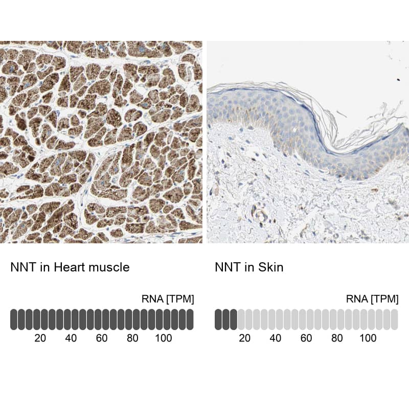 Analysis in human heart muscle and skin tissues Corresponding NNT RNA-seq data are presented for the same tissues.