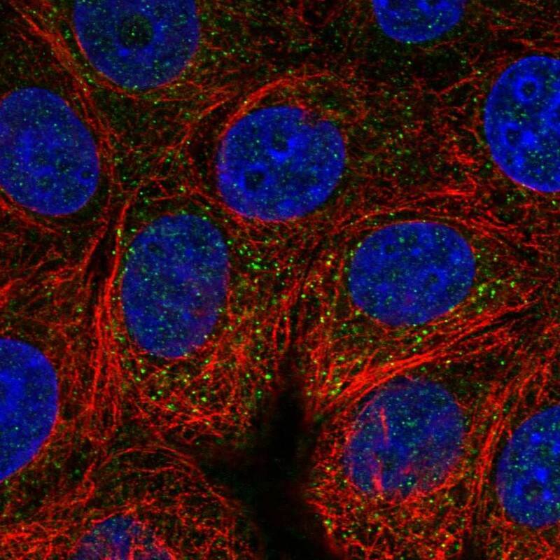 Staining of human cell line MCF7 shows localization to vesicles.