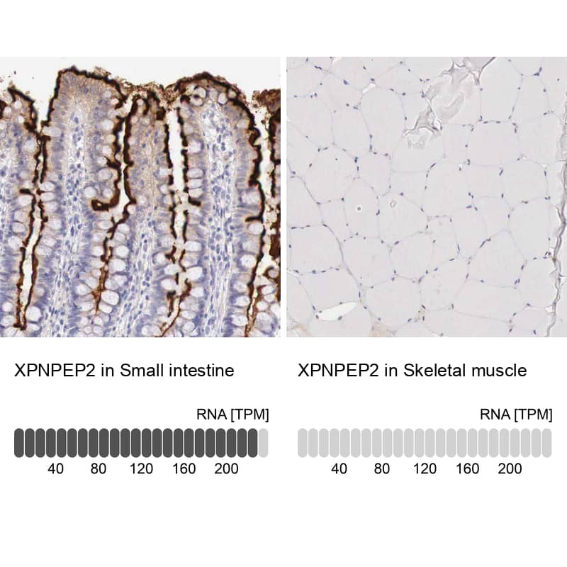 Analysis in human small intestine and skeletal muscle tissues Corresponding XPNPEP2 RNA-seq data are presented for the same tissues.