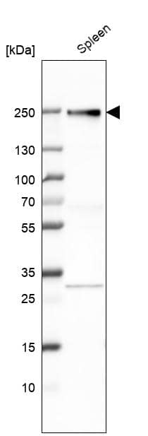 Analysis in human spleen tissue.