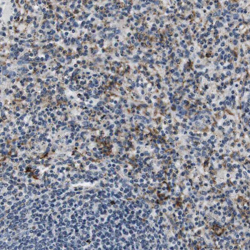 Staining of human spleen shows strong cytoplasmic positivity in cells in red pulp.