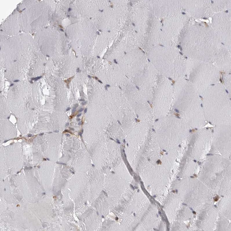 Staining of human skeletal muscle shows no positivity in myocytes as expected.