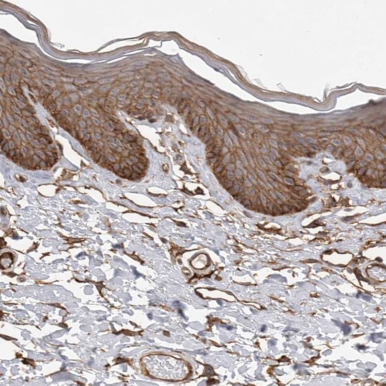 Staining of human skin shows strong membranous positivity in squamous epithelial cells.