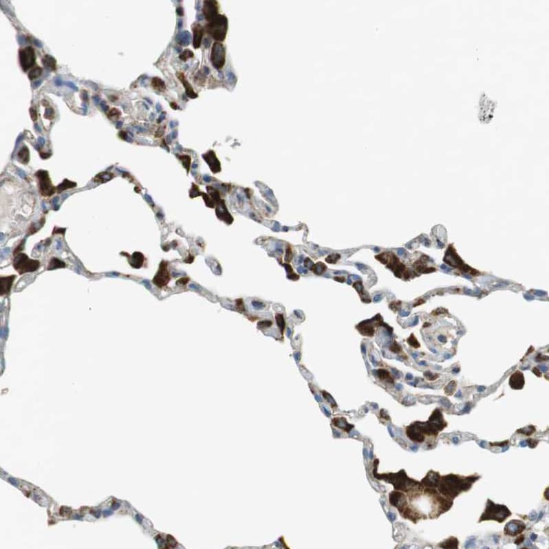 Staining of human lung shows strong granular cytoplasmic positivity in macrophages.