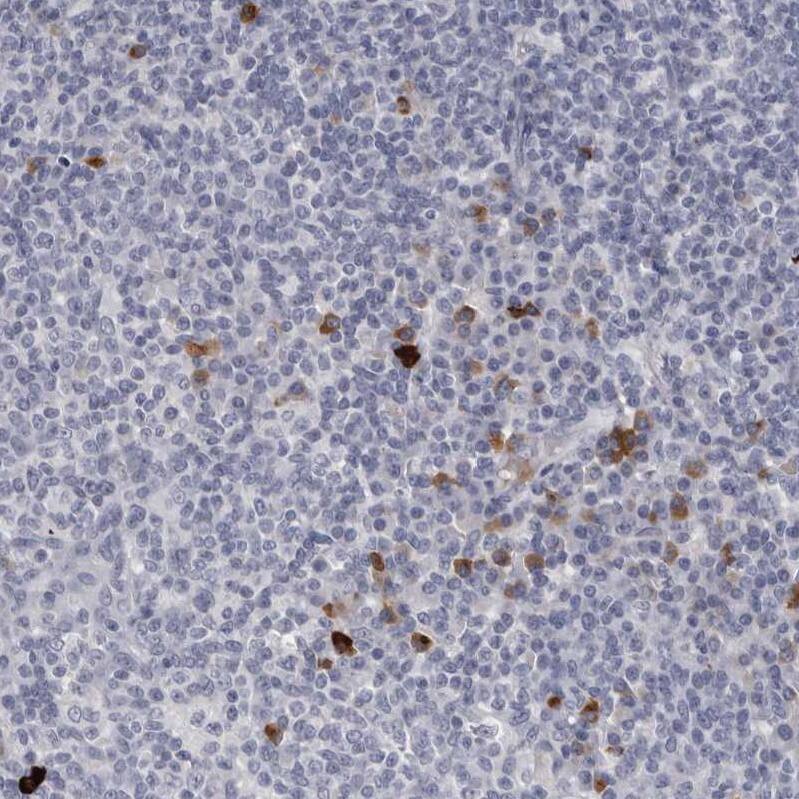 Immunohistochemistry-Paraffin Granzyme H Antibody - BSA Free