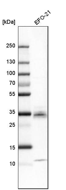 Analysis in human cell line EFO-21.